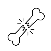 Переломы